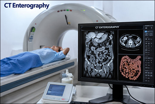 CT Enterography
