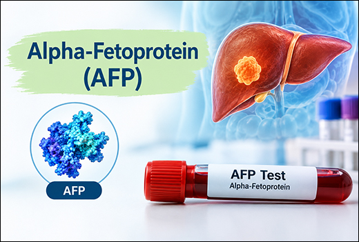 Alpha-Fetoprotein (AFP)